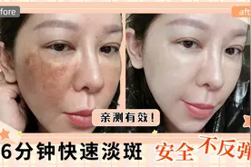 1分钟学会安全快速祛斑，不用白醋也能白，每天6分钟28天给你惊喜视频封面