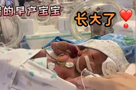 27周出生644g哒早产宝宝长大了❣️回忆过去种种不易，现在很幸福视频封面