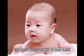 为什么宝宝头发稀疏？视频封面