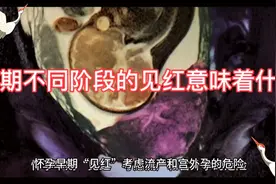孕期不同阶段的见红意味着什么视频封面