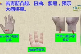 手诊：青筋观健康（看心脑系统）：视频封面