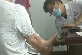 腰椎间盘突出引起脚痛视频封面