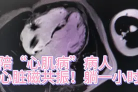 一个要躺一个小时的检查！心脏磁共振