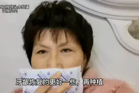 陪伴我60年的门牙下岗了，种牙究竟是什么感觉？现在种牙贵不贵？视频封面