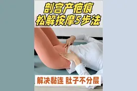 剖腹产必备手法，在家就能做无黏连无分层视频封面