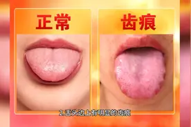 茯苓薏米茶，脾虚有湿气的人喝了能健脾祛湿，身体一天比一天清爽