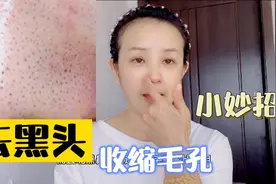 一元成本小妙招，去黑头收缩毛孔，效果超赞视频封面