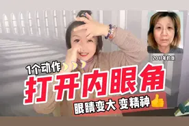 无需医美0元打开内眼角，眼睛变大变圆特好看，坚持7天打卡看变化视频封面