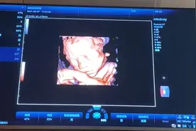 看四维彩超男女生视频封面