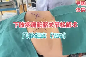 乡医杨涛：下肢疼痛，腿疼，弯腰困难，有可能是骶髂关节引起的视频封面