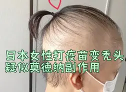 日本女子打疫苗后变秃头，疑似莫德纳副作用？视频封面