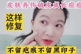 皮肤弄伤破皮或长痘痘后这样修复，不留疤痕不留黑印子，超赞视频封面