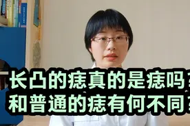 长凸的痣真的是痣吗？和普通的痣有何不同？视频封面