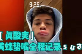 国外一小伙被黄蜂蛰嘴，全程记录，含泪爆笑看香肠嘴是怎么来的！视频封面