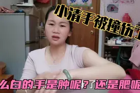 小清手扭伤了，在擦白米酒有效果吗？看看她这手是肿，还是肥肉呢视频封面