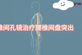 高清动画演示椎间孔镜治疗腰椎间盘突出症！视频封面