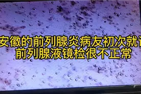安徽的前列腺炎病友初次就诊，前列腺液镜检很不正常。视频封面