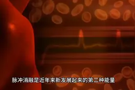 脉冲消融来啦！房颤患者的福音！视频封面