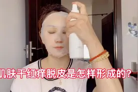 皮肤干燥发红还脱皮怎么回事？注意这六点，皮肤退红保湿效果好视频封面