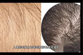 我本女儿身，为什么全身长毛像男孩？视频封面