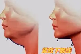 3个动作紧致下颚线，恢复20岁少女脸，坚持做50岁也不衰老视频封面