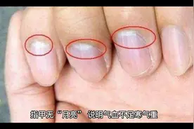 指甲无月亮，说明气血不足，寒气重视频封面