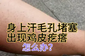 汗毛孔堵塞，出现鸡皮疙瘩解决办法视频封面