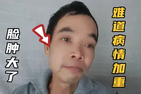 鼻咽癌晚期患者，一夜之间脸部变形了，难道生命倒计时了视频封面
