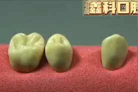 种植牙为什么要分三期做完视频封面
