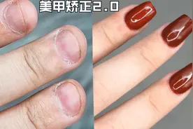 真丑指甲！适合粗短宽的整容级美甲教程【矫正｜肉包甲】视频封面