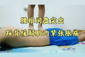 小伙腰突保守治疗第87天，五十斤小孩踩背，缓解肌肉紧张疲劳胀痛视频封面