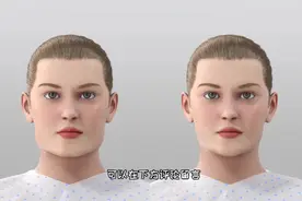 面部整容之削骨瘦脸术，3D演示。。视频封面