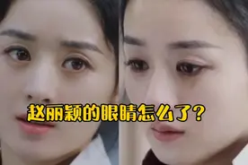 赵丽颖的眼睛怎么了？视频封面