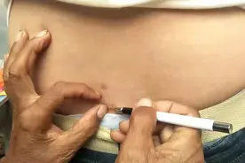 痣瘘针挑中，痊愈后终生不复发视频封面
