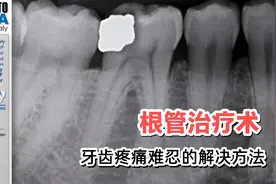 解决牙齿疼痛的方法在这里，晚上痛  吃东西痛  喝凉水痛视频封面
