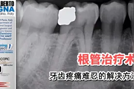 解决牙齿疼痛的方法在这里，晚上痛  吃东西痛  喝凉水痛视频封面