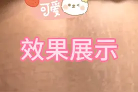 妊娠纹修复视频封面