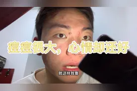 记录）小伙眉目间两个巨大的痘痘，路人看到都害怕视频封面