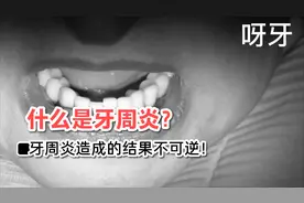 牙周炎可不敢忽视！因牙周炎造成的一系列的问题视频封面