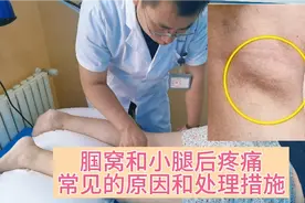 腘窝和小腿后疼痛，临床上常见的原因和处理措施！视频封面