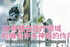 3D骨骼在医疗领域的确有许多神奇的作用视频封面