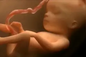 孕妈胎动的厉害，图像清晰可见宝宝在肚子里真的拳打脚踢⋯好欢乐视频封面