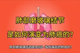 肺部磨玻璃结节是如何一步步演变为肺癌的?视频封面