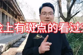 面部有斑点的，每天坚持这样做＃健康养生＃中老年健身操视频封面