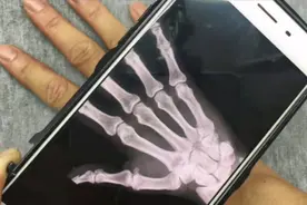 教你开启手机“透视”功能，手上的骨骼清晰可见，太神奇了视频封面