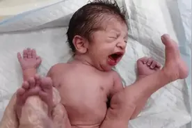臀位出生的宝宝，妈妈初见瞬间尖叫，惊喜还是惊吓？视频封面