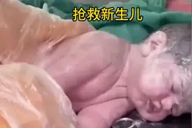 刚出生的宝宝宫内缺氧停止呼吸 医生奋力抢救视频封面