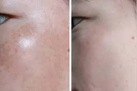 3味中草药磨成粉，再顽固的斑点也能淡化，恢复白嫩肌肤视频封面