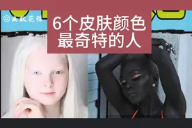 6种皮肤最奇特的人，你见过吗？？视频封面