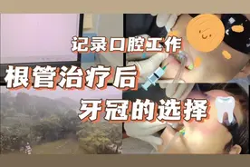 如何选择牙冠！！！视频封面